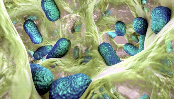 legionella baktériumok - biofilm